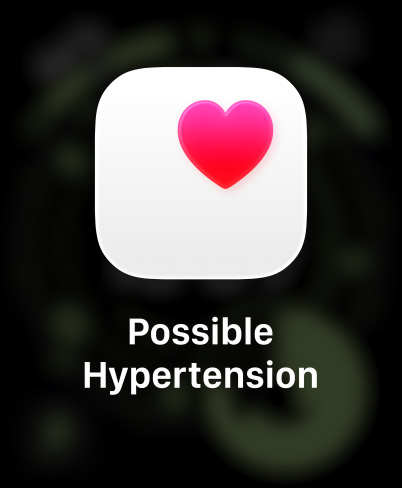 Apple Watch Ultra 3, titánový kryt, prírodná farba, hlásenie o možnej hypertenzii, ružové srdce v bielom štvorci, remienok, trailová slučka, modrá/jasná modrá farba