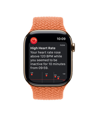 Apple Watch Series 11, titanium case gold colour, High heart rate notification, Braided Solo Loop, turmeric colour
